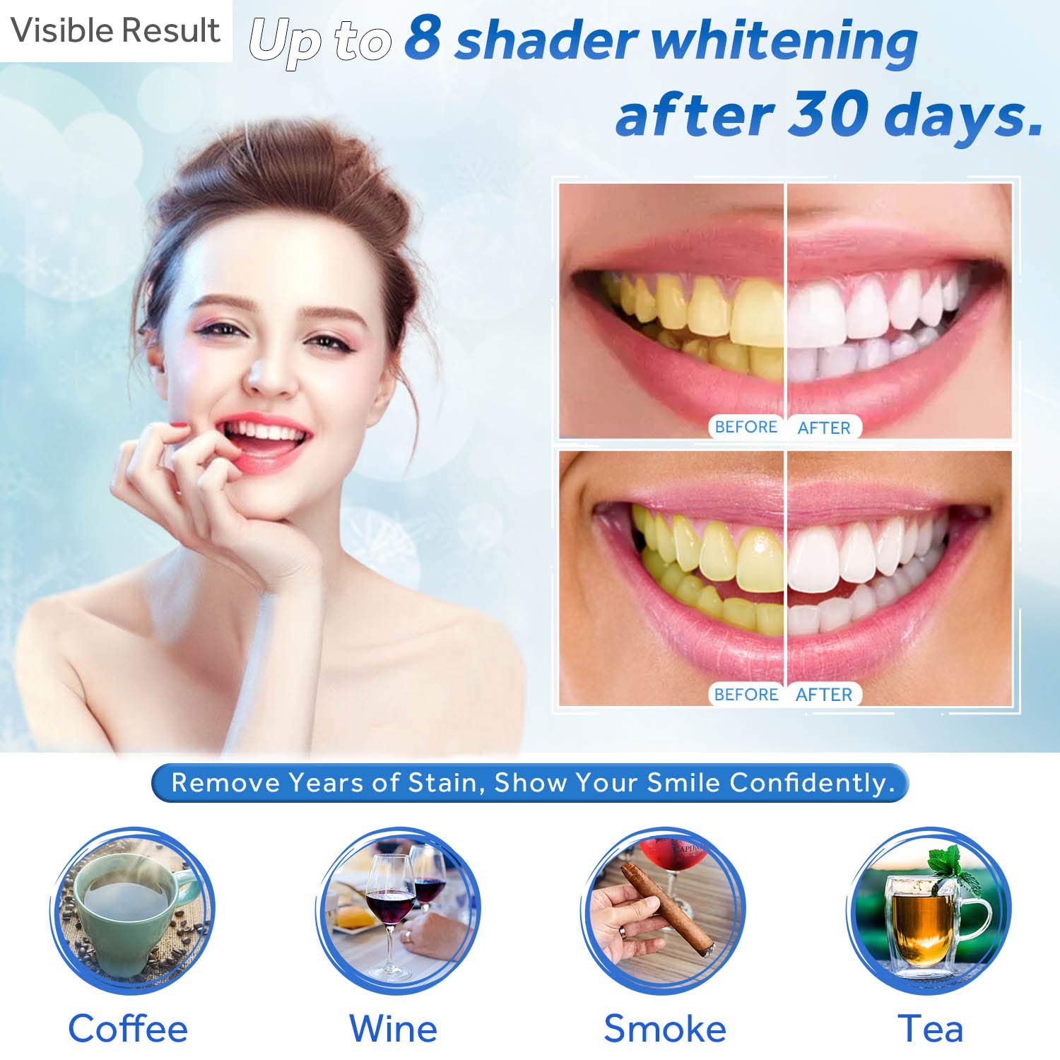 Teeth Whitening Gel Refill Syr - Teeth Whitening Levels ulasan dan harga