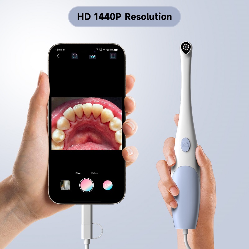 Oral Endoscope Camera 1440P Ph - Teeth Whitening Video ulasan dan harga