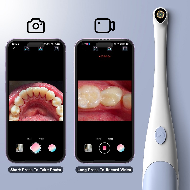 Oral Endoscope Camera 1440P Ph - Teeth Whitening Video ulasan dan harga
