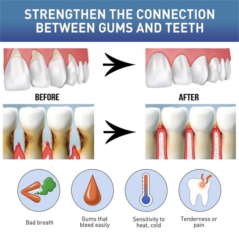 Rapid Repair Gums Serum Effect - Teeth Whitening Foam ulasan dan harga