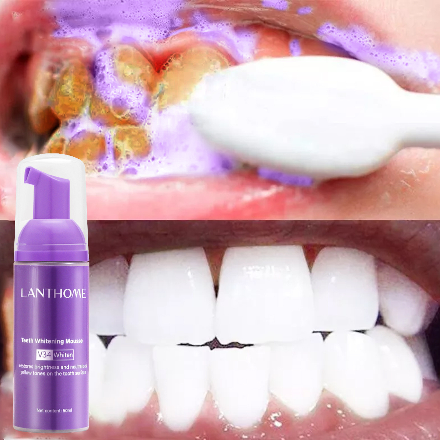 V34 Teeth Whitening Mousse Too - Teeth Whitening (Bleaching) ulasan dan harga