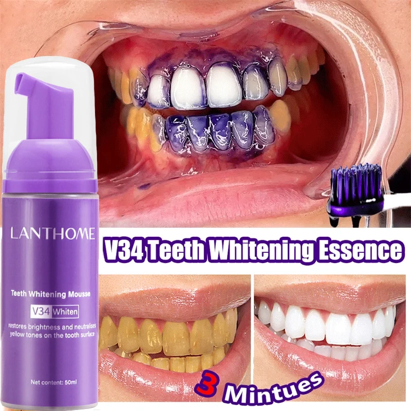V34 Teeth Whitening Mousse Too - Teeth Whitening (Bleaching) ulasan dan harga