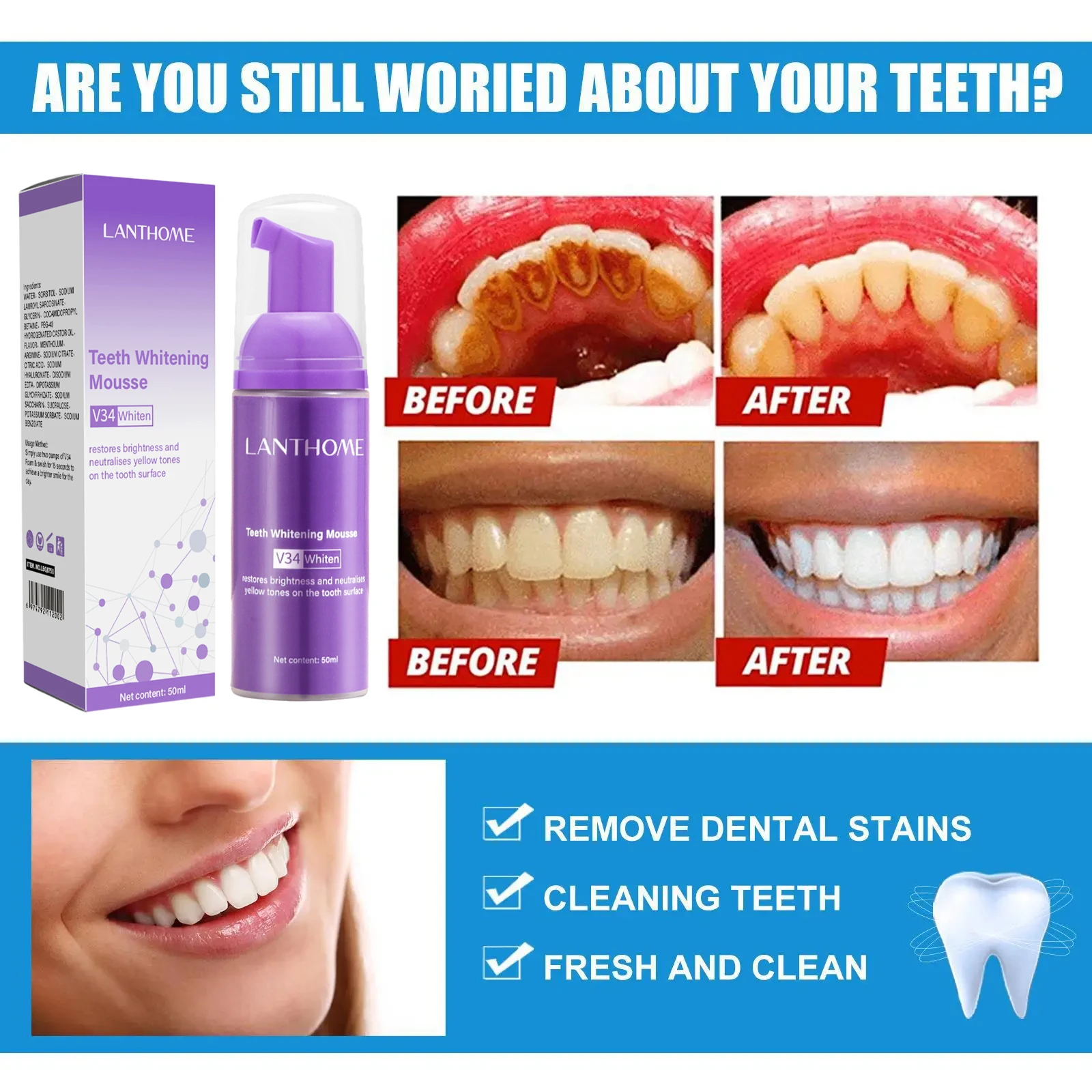V34 Teeth Whitening Mousse Too - Teeth Whitening (Bleaching) ulasan dan harga
