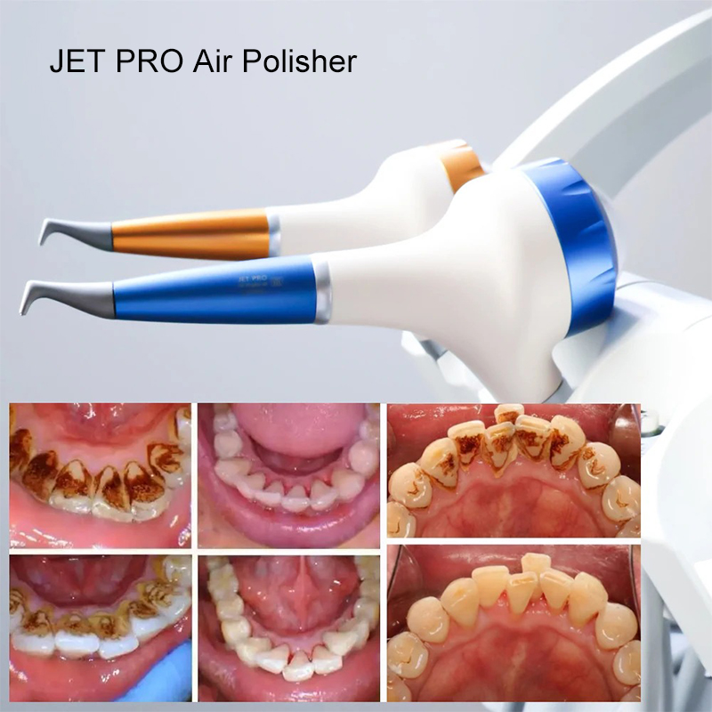 VV Dental  Air Polishing Proph - Teeth Whitening China ulasan dan harga