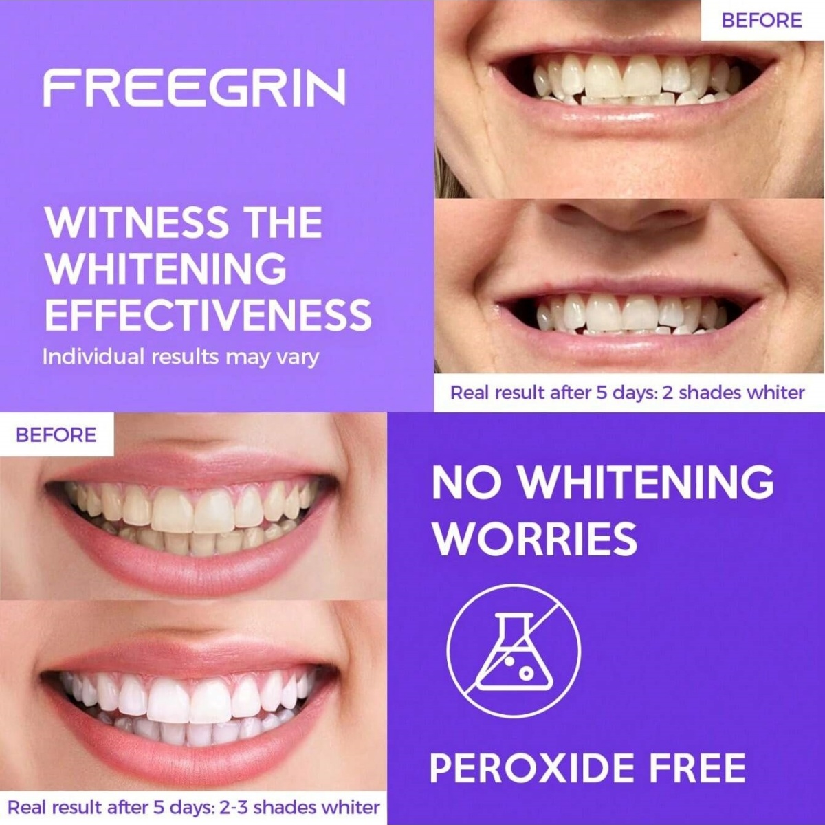 Deluxe Whitening Teeth Sticker - Teeth Whitening Foam ulasan dan harga