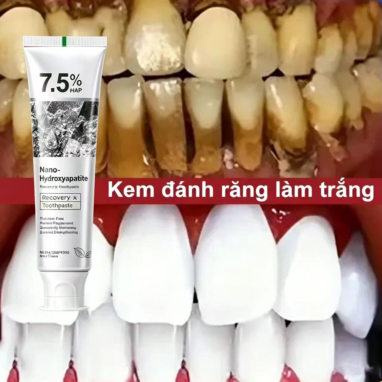 7.5% Hydroxyapatite Probiotic  - Teeth Whitening That Works ulasan dan harga