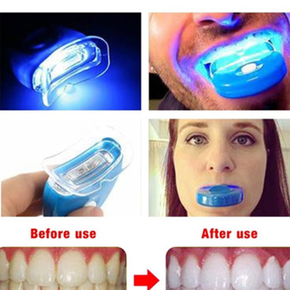 New Blue Led Teeth Whitening A - Teeth Whitening Video ulasan dan harga