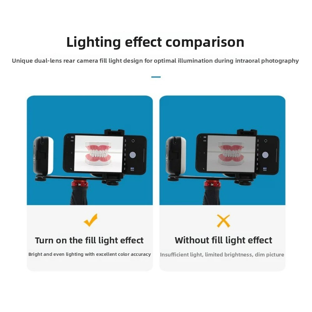 Dental Photography Light, Blue - Teeth Whitening Light Kit ulasan dan harga